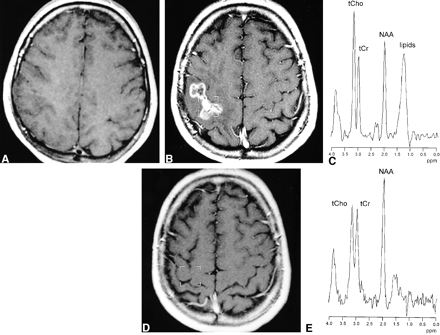 fig 2.
