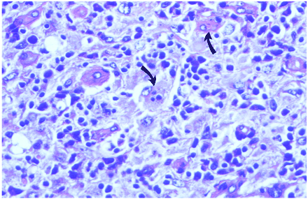fig 2.