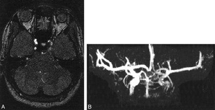 fig 1.