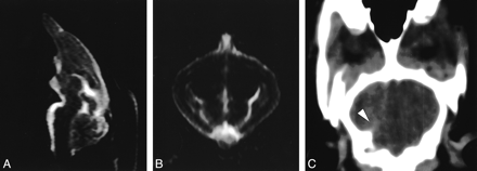 fig 3.