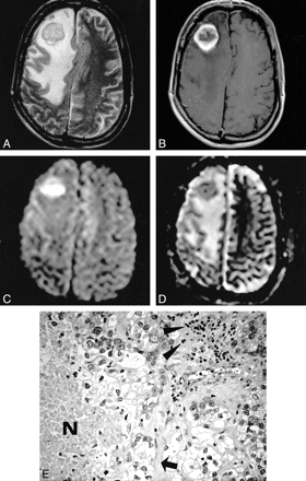 fig 1.