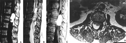 fig 1.