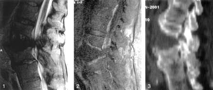 Fig 2.