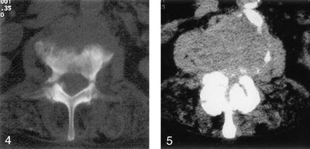 Fig 4.