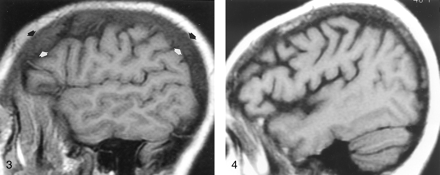 Fig 4.