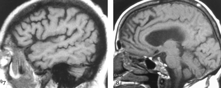Fig 7.