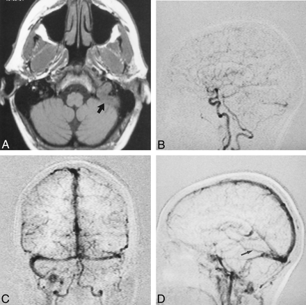 Fig 2.