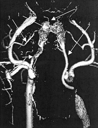Fig 1.