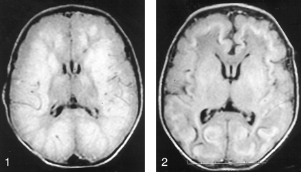 Fig 1.