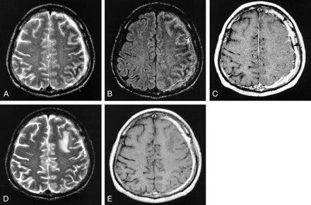 Fig 2.