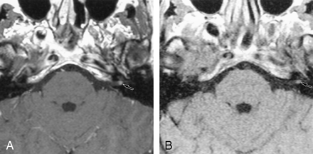 Fig 1.