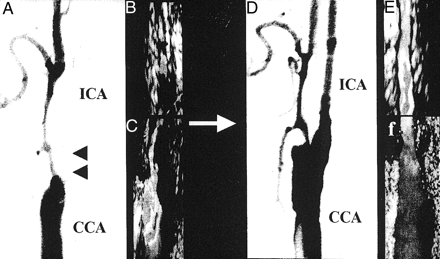 Fig 1.