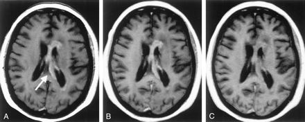 Fig 3.