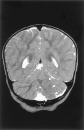 Fig 12.