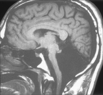 Fig 3.