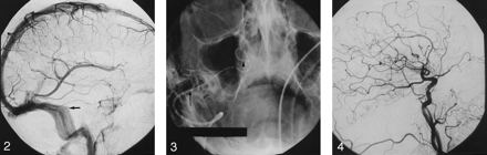 Fig 4.