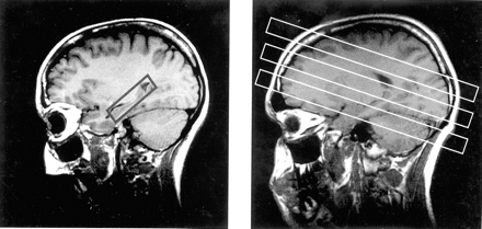 Fig 1.