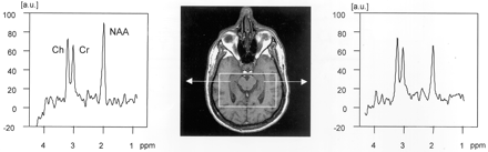 Fig 3.