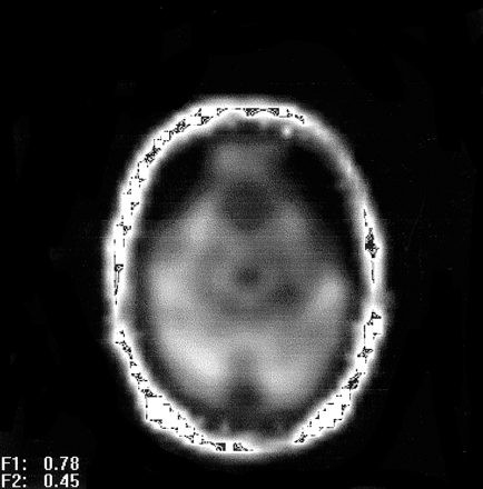 Fig 5.