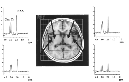 Fig 3.