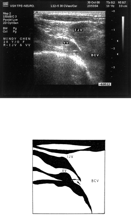 Fig 1.