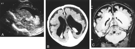 Fig 4.