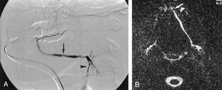 Fig 5.