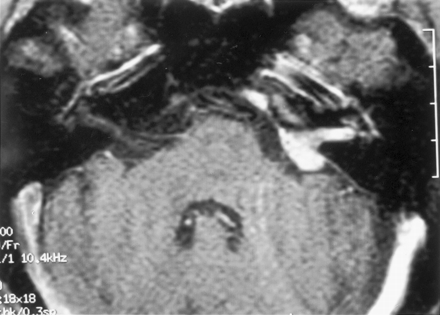 Fig 3.