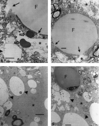 Fig 9.