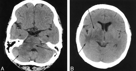 Fig 1.