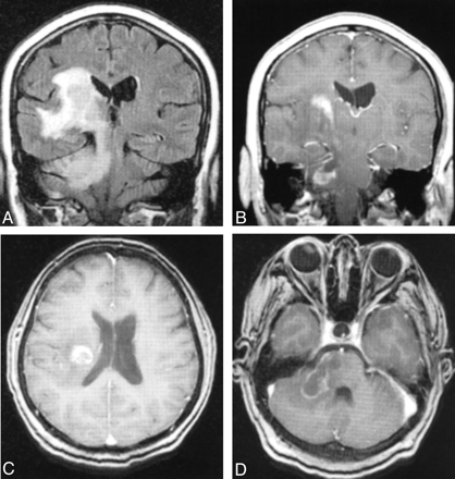Fig 2.