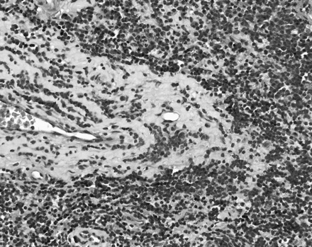 Fig 10.
