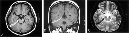 Fig 2.