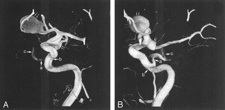 Fig 3.