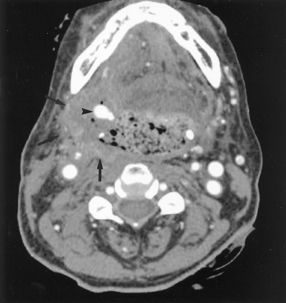 Fig 1.