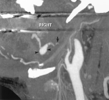 Fig 2.