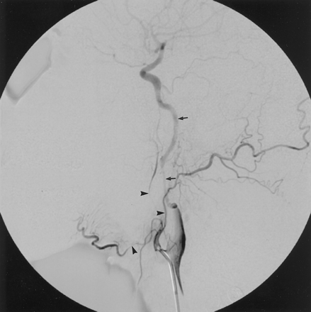 Fig 3.
