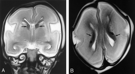 Fig 1.