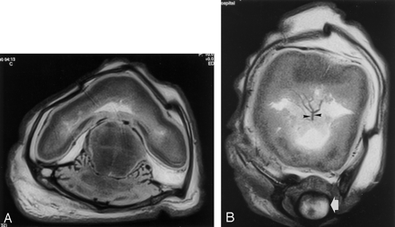 Fig 2.