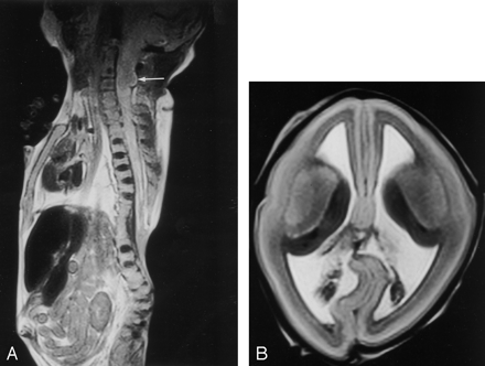 Fig 3.