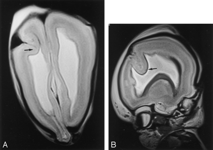 Fig 4.