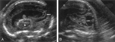 Fig 2.