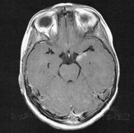 Fig 1.