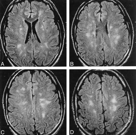 Fig 1.