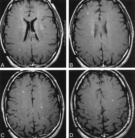 Fig 2.