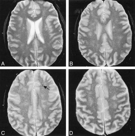 Fig 3.