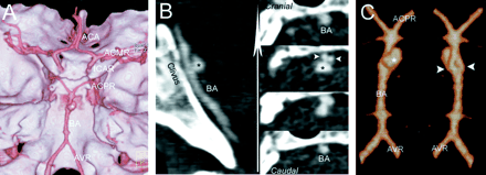 Fig 1.