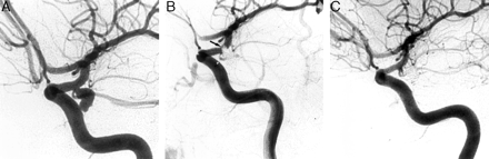 Fig 2.