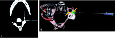 Fig 4.