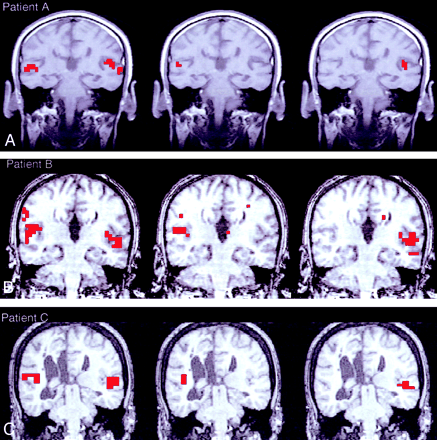 Fig 2.